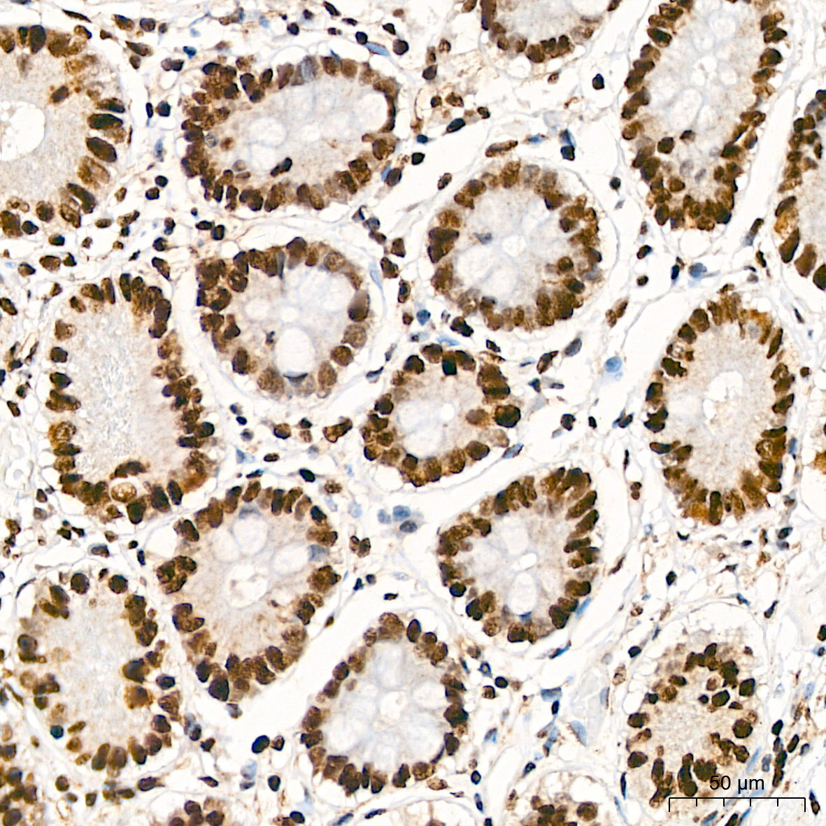 Phospho-AKT1-S473 Rabbit Polyclonal Antibody - Image 7