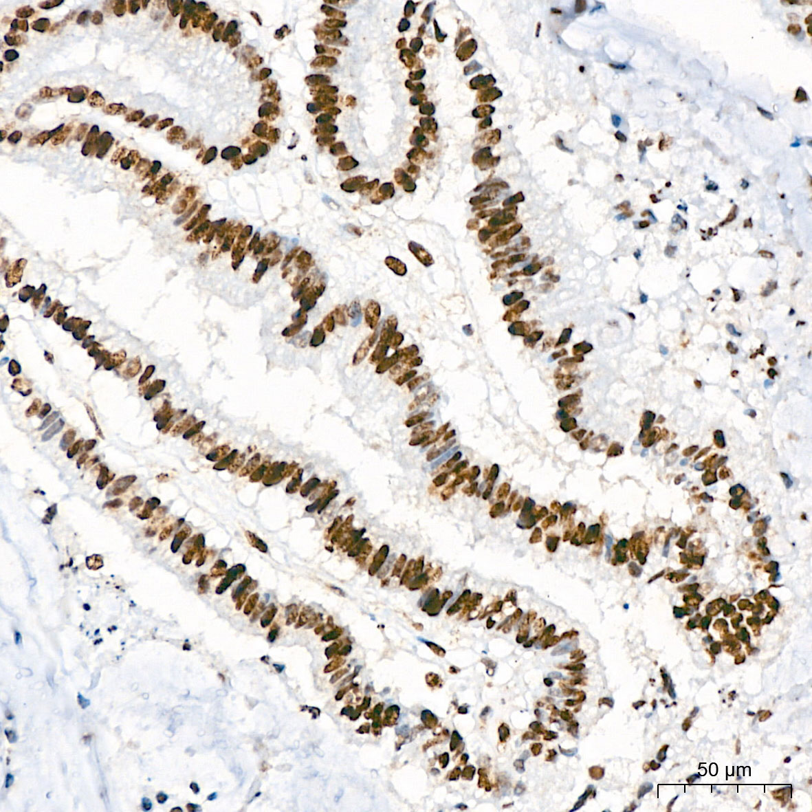 Phospho-AKT1-S473 Rabbit Polyclonal Antibody - Image 8
