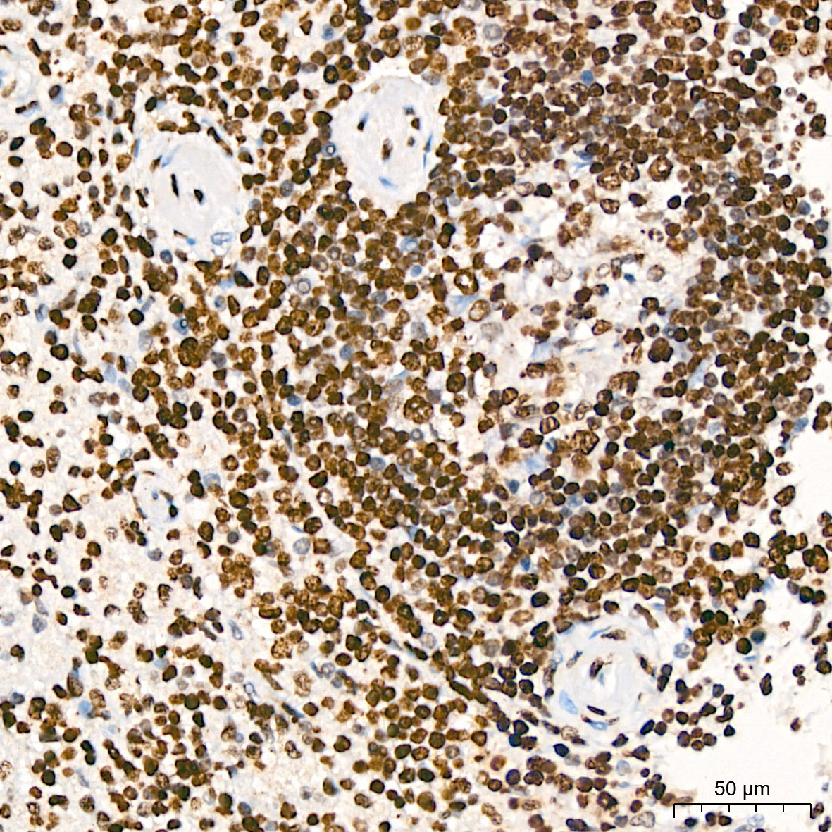 Phospho-AKT1-S473 Rabbit Polyclonal Antibody - Image 9