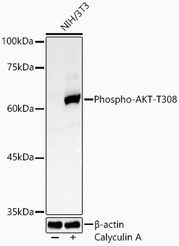 Phospho-AKT1-T308 Rabbit Polyclonal Antibody