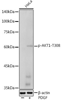 Phospho-AKT1-T308 Rabbit Polyclonal Antibody