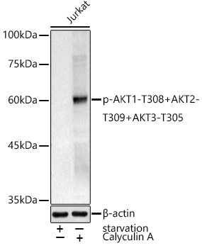Phospho-AKT1-T308+AKT2-T309+AKT3-T305 Rabbit Polyclonal Antibody