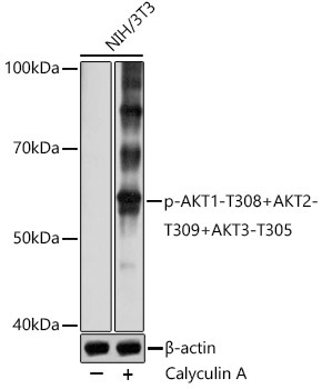 Phospho-AKT1-T308+AKT2-T309+AKT3-T305 Rabbit Polyclonal Antibody