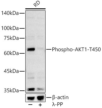 Phospho-AKT1-T450 Rabbit Polyclonal Antibody
