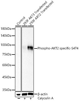 Phospho-AKT2 specific-S474 Rabbit Polyclonal Antibody - Image 2