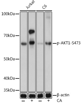 Phospho-AKT-S473 Rabbit Monoclonal Antibody