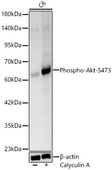 Phospho-Akt-S473 Rabbit Polyclonal Antibody