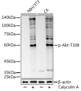 Phospho-Akt-T308 Rabbit Monoclonal Antibody
