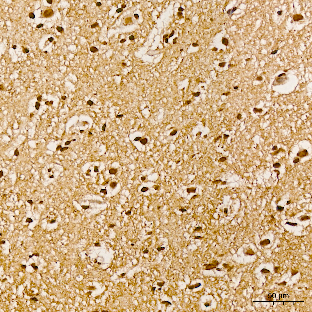 Phospho-Akt-Y315 Rabbit Polyclonal Antibody