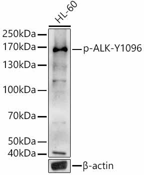 Phospho-ALK-Y1096 Rabbit Polyclonal Antibody