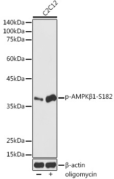 Phospho-AMPKBeta1-S182 Rabbit Polyclonal Antibody