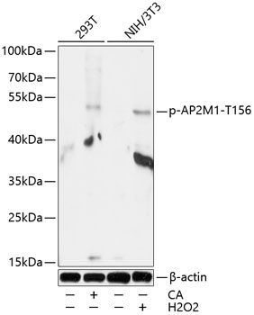 Phospho-AP2M1-T156 Rabbit Polyclonal Antibody