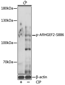 Phospho-ARHGEF2-S886 Rabbit Polyclonal Antibody
