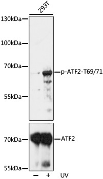 Phospho-ATF2-T69/71 Rabbit Polyclonal Antibody