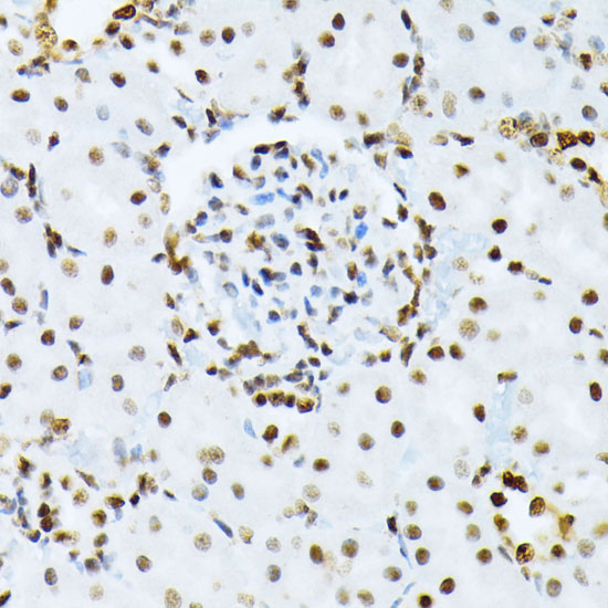 Phospho-ATF2-T69/71 Rabbit Polyclonal Antibody - Image 2