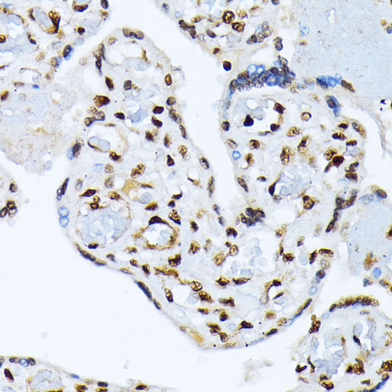 Phospho-ATF2-T69/71 Rabbit Polyclonal Antibody - Image 3
