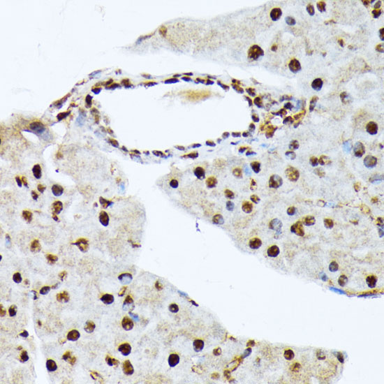 Phospho-ATF2-T69/71 Rabbit Polyclonal Antibody - Image 4