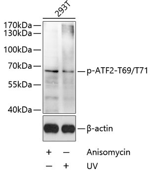Phospho-ATF2-T69/T71 Rabbit Polyclonal Antibody