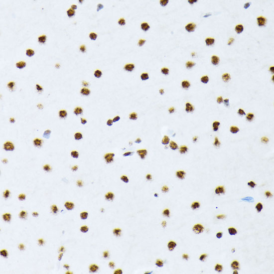 Phospho-ATF2-T69/T71 Rabbit Polyclonal Antibody - Image 2