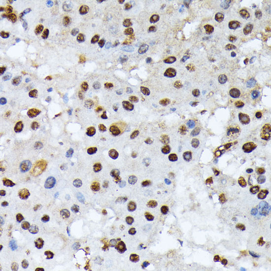 Phospho-ATF2-T69/T71 Rabbit Polyclonal Antibody - Image 3