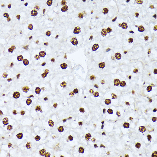 Phospho-ATF2-T69/T71 Rabbit Polyclonal Antibody - Image 4