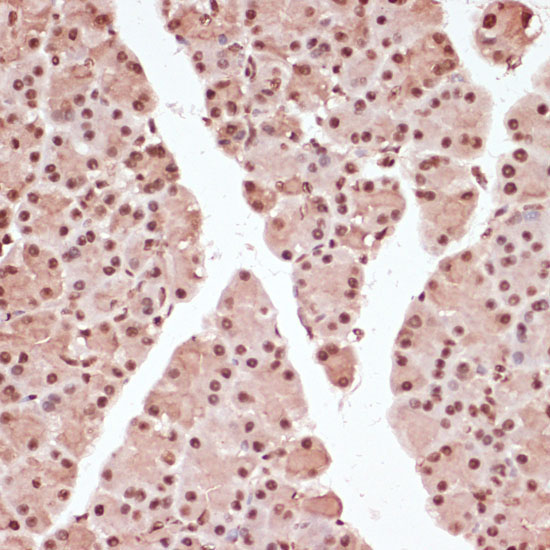 Phospho-ATF2-T71 Rabbit Polyclonal Antibody - Image 2