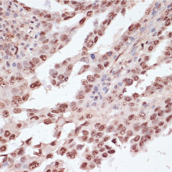 Phospho-ATF2-T71 Rabbit Polyclonal Antibody - Image 3