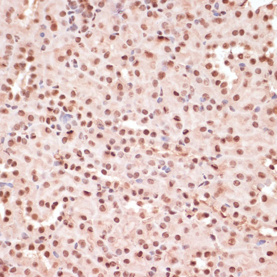 Phospho-ATF2-T71 Rabbit Polyclonal Antibody - Image 4