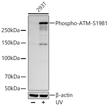 Phospho-ATM-S1981 Rabbit Monoclonal Antibody