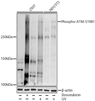 Phospho-ATM-S1981 Rabbit Polyclonal Antibody