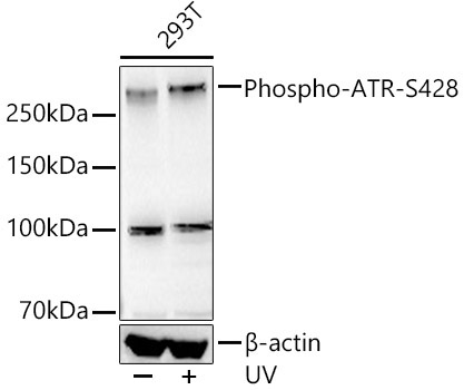 Phospho-ATR-S428 Rabbit Monoclonal Antibody