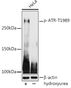 Phospho-ATR-T1989 Rabbit Polyclonal Antibody