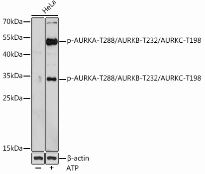 Phospho-AURKA-T288/AURKB-T232/AURKC-T198 Rabbit Polyclonal Antibody