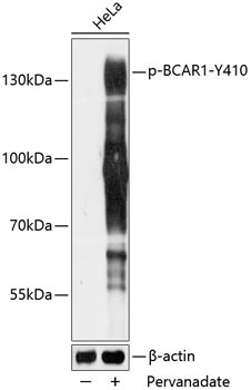 Phospho-BCAR1-Y410 Rabbit Polyclonal Antibody