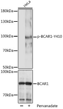 Phospho-BCAR1-Y410 Rabbit Polyclonal Antibody