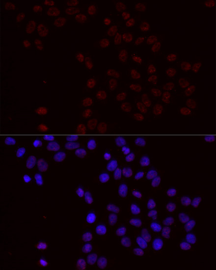 Phospho-Bcl-2-S70 Rabbit Polyclonal Antibody - Image 2