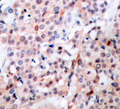 Phospho-Bcl-2-T56 Rabbit Polyclonal Antibody