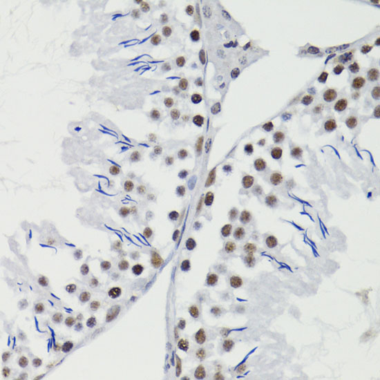 Phospho-Bcl-2-T56 Rabbit Polyclonal Antibody - Image 2