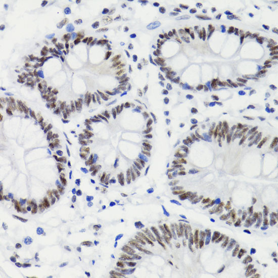Phospho-Bcl-2-T56 Rabbit Polyclonal Antibody - Image 3