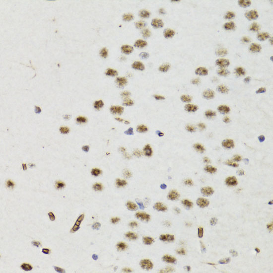 Phospho-Bcl-2-T56 Rabbit Polyclonal Antibody - Image 4