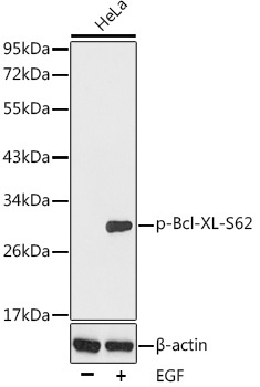 Phospho-Bcl-XL-S62 Rabbit Polyclonal Antibody