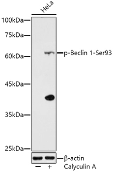 Phospho-Beclin 1-Ser93 Rabbit Polyclonal Antibody