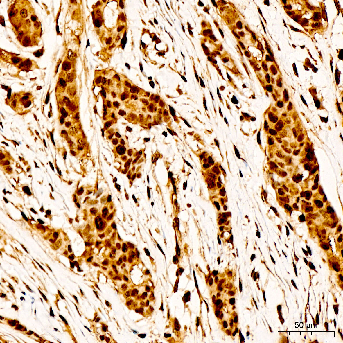 Phospho-BRCA1-S988 Rabbit Polyclonal Antibody