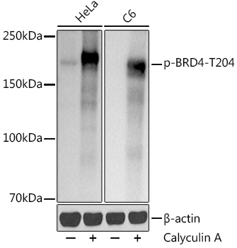 Phospho-BRD4-T204 Rabbit Monoclonal Antibody