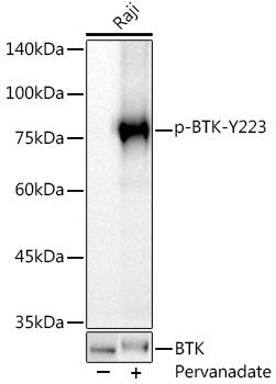 Phospho-BTK-Y223 Rabbit Monoclonal Antibody