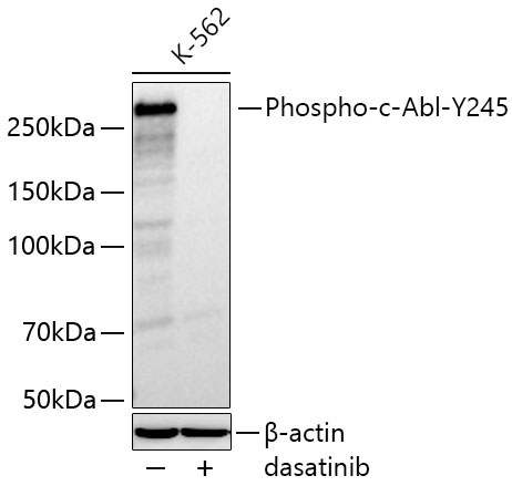 Phospho-c-Abl-Y245 Rabbit Polyclonal Antibody