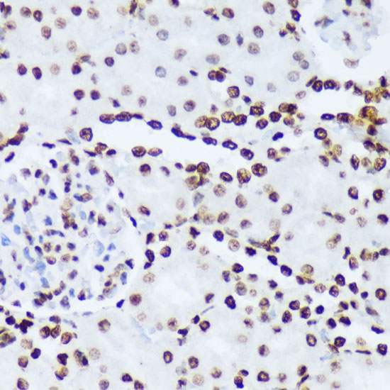 Phospho-c-Abl-Y245 Rabbit Polyclonal Antibody - Image 3