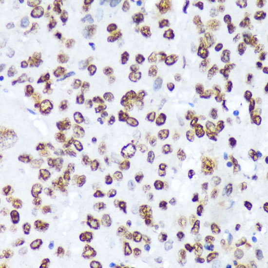 Phospho-c-Abl-Y245 Rabbit Polyclonal Antibody - Image 4