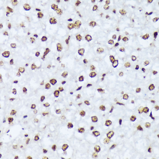 Phospho-c-Abl-Y245 Rabbit Polyclonal Antibody - Image 5