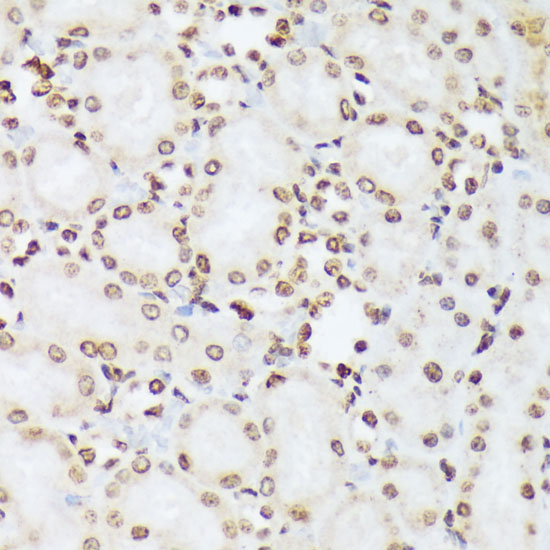 Phospho-c-Abl-Y412 Rabbit Polyclonal Antibody - Image 2